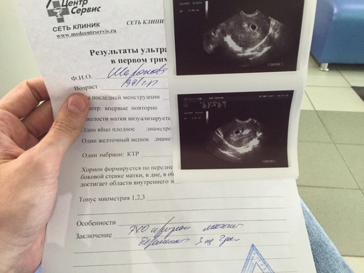 Наше первое фото) — 21 ответов на Babyblog