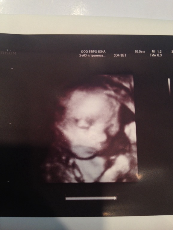 30 week pregnant