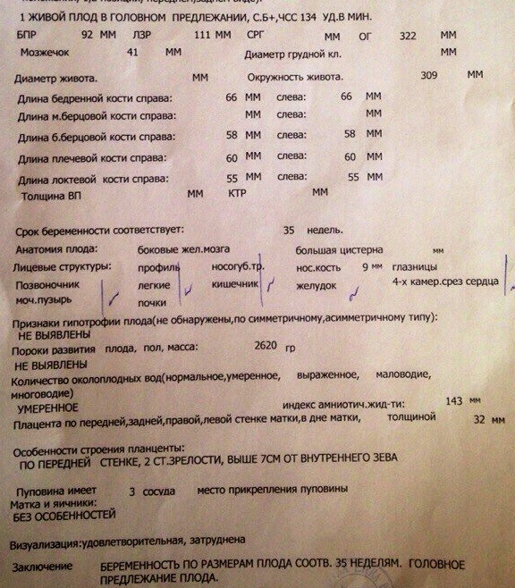 Вот это даааа :-)