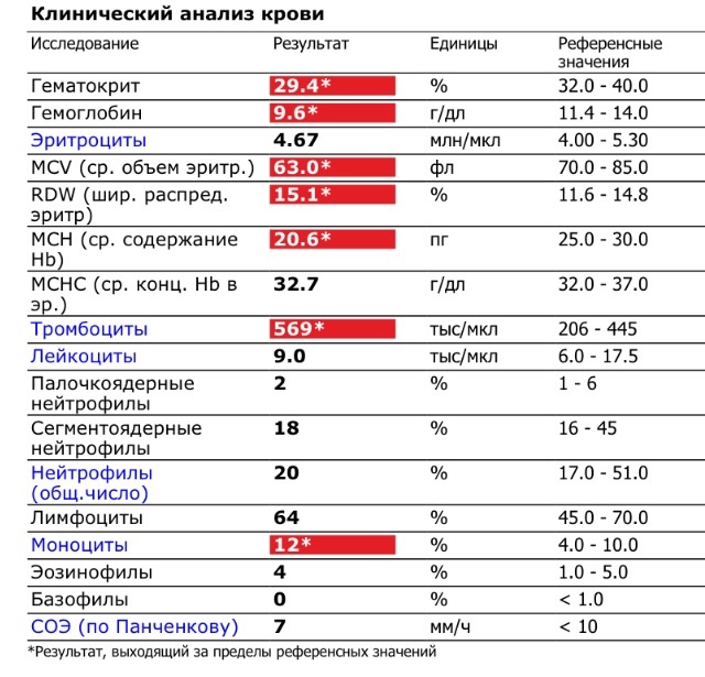 Нормальный анализ мочи у женщин фото