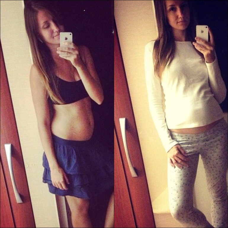 естественные роды после КС.