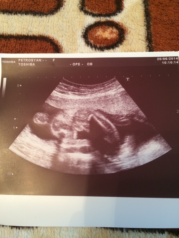 Мальчик или девочка?