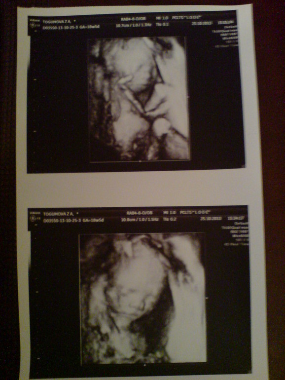 полноценная встреча с моим чудом №2