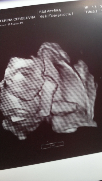 Мы замерли в ожидании  :)