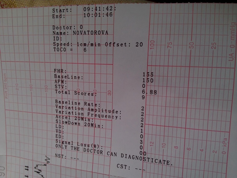 Расшифруйте КТГ?