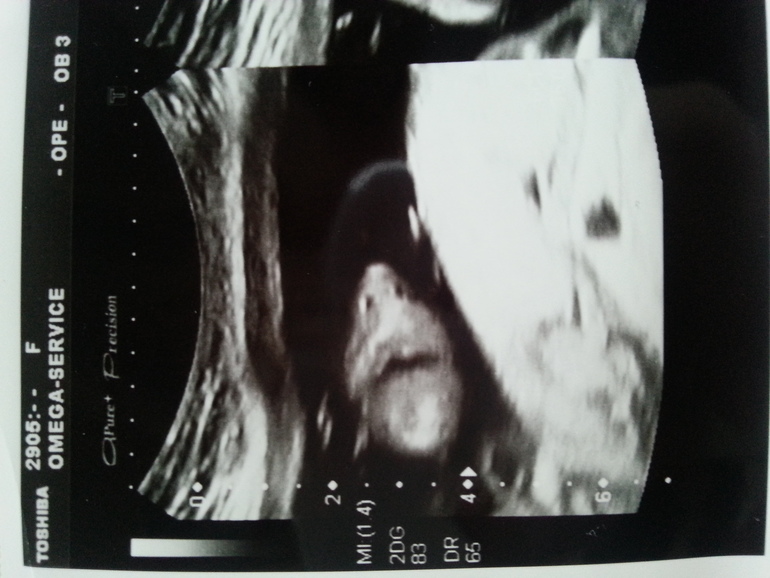 Мой экватор...