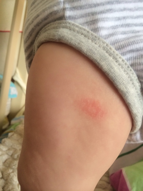 Девочки это что АД? Фото внизу