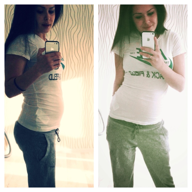 20,1 недельки❤️❤️❤️❤️фото масика!