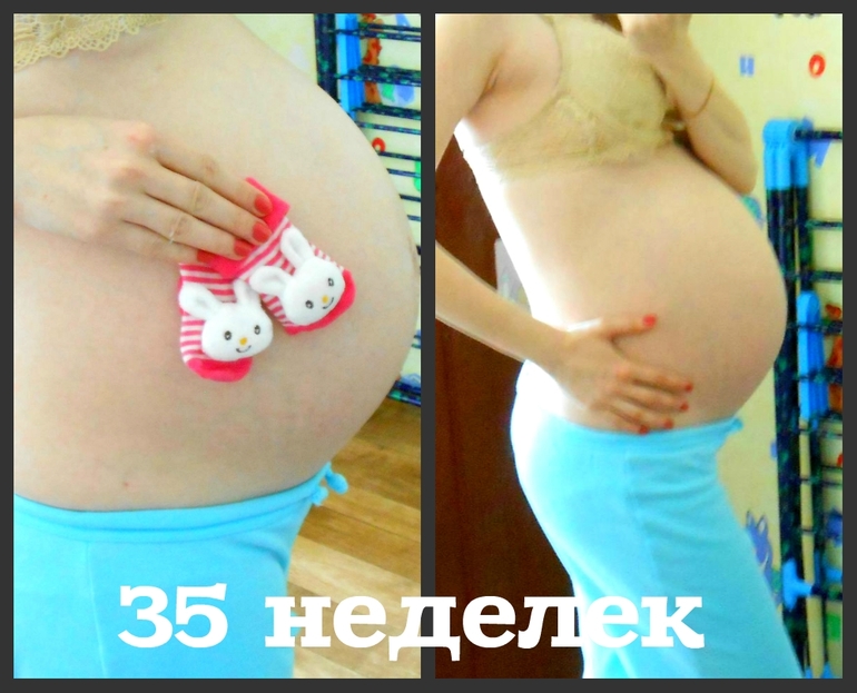 35 неделек