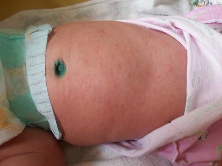 Аллергия или что-то другое?