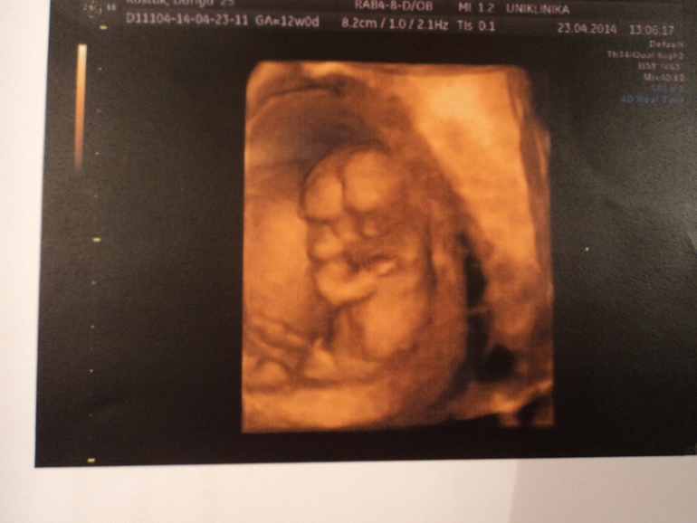 Первый скрининг! )))