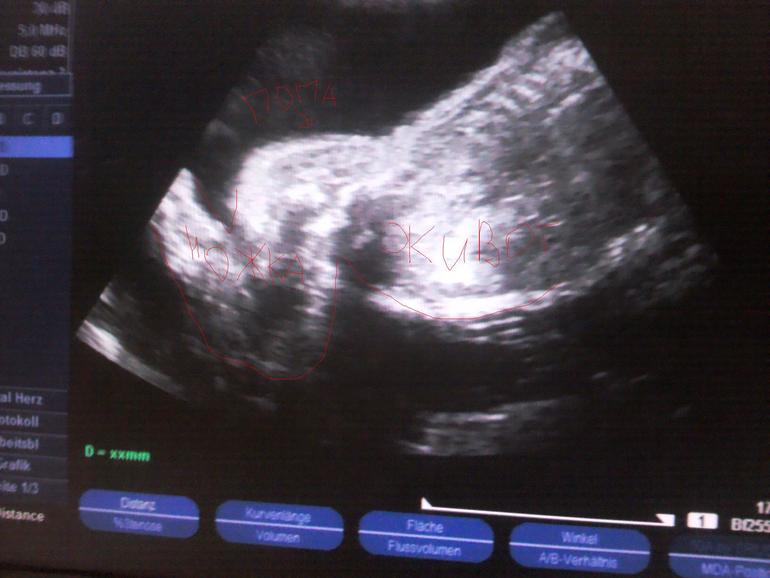 Наша 28 неделька