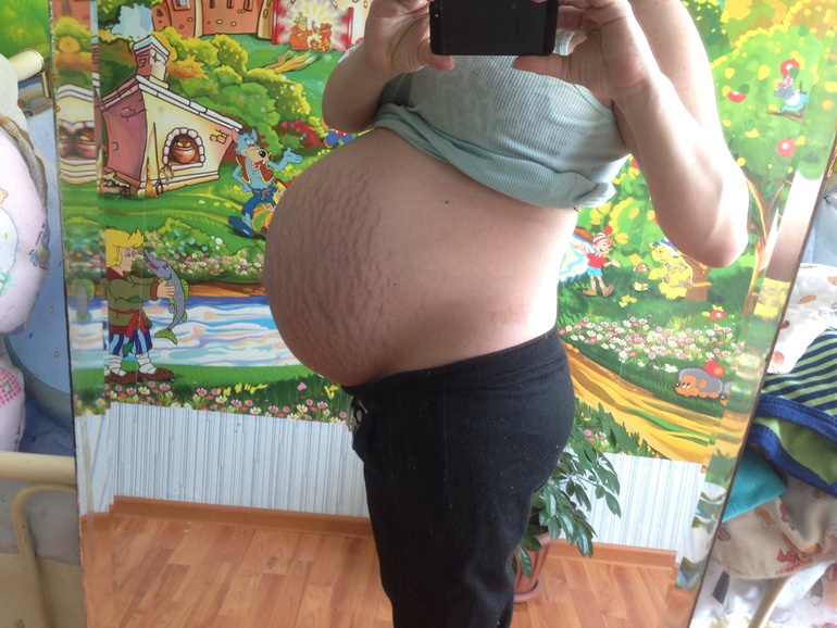 Наши 36 недель.