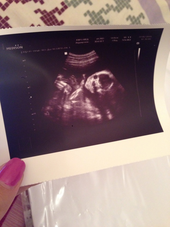 Мы ужасно нетерпеливые родители :)