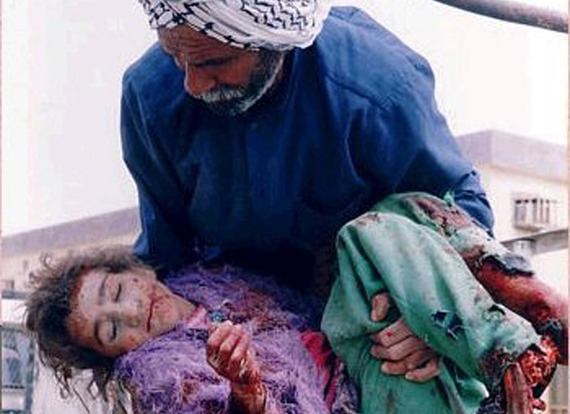 Кто же агрессор? слабонервным не смотреть...