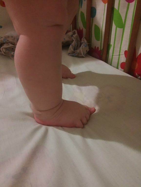 Ножки в 6 месяцев. Гипертонус ног у ребенка. Гипертонус стопы у детей. Гипертонус ног у грудничка.