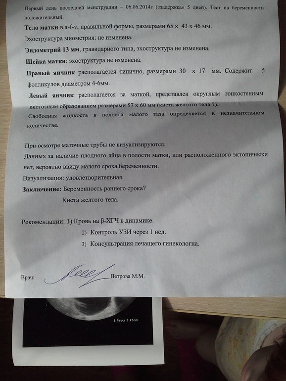 в ожидании чуда 4 нед 4 дня