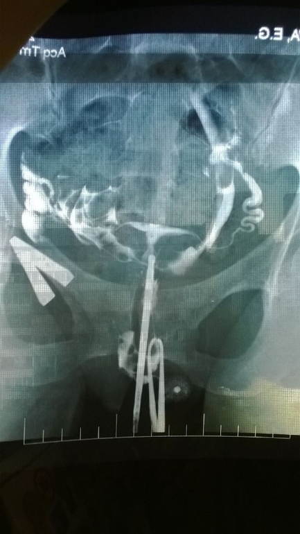 Посмотрите мой снимок ГСГ , плиизз!