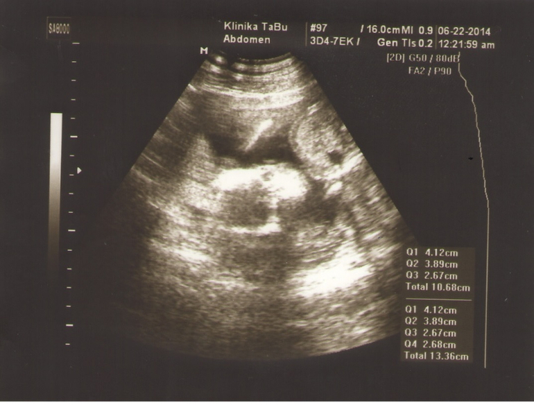 Пришла с узи, счастлива!!! 18 неделька и у нас сыночек!!!