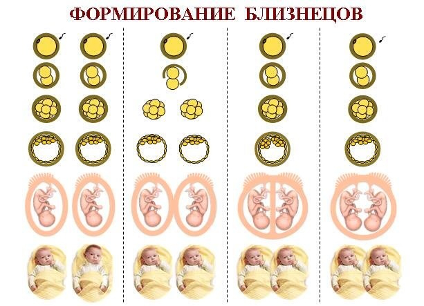 Как забеременеть двойней или близнецами естественным путем