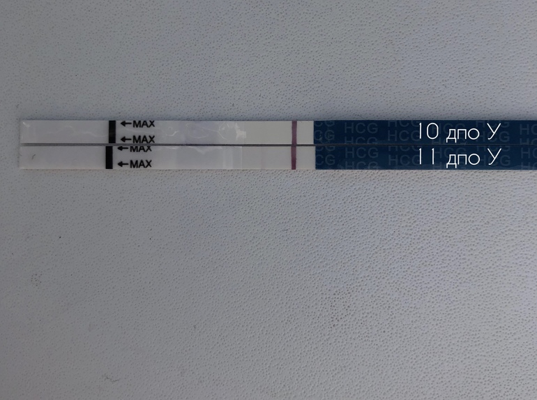 11 дпо. Эви тесты динамика 10 ДПО. 10-11 ДПО тест. Тест 11 ДПО тест 10ме. 12 ДПО тест динамика.