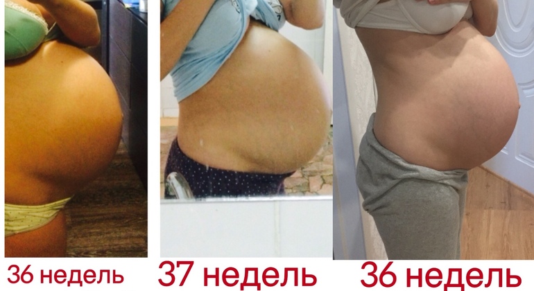 3 беременность 35 недель. Опускание живота при беременности. Опустился живот на 35 неделе беременности.