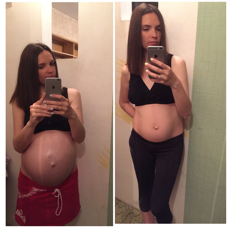 Через месяц после родов форум. Живот до и после беременности. Живот сразу после родов и после. Живот до и сразу после родов.