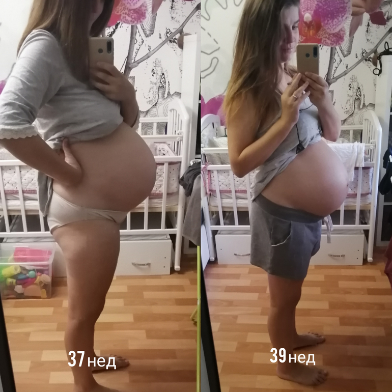 38 недель опустился живот. Опустился живот фото до и после. Опустившийся живот перед родами. Опустился живот при беременности. Опущенный живот при беременности.