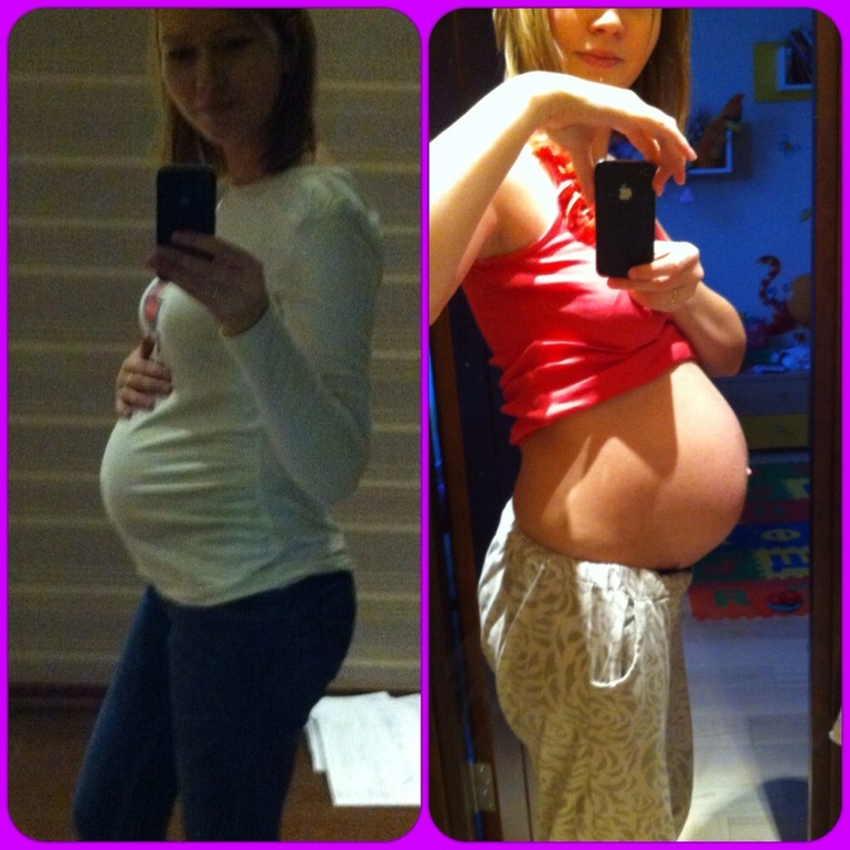 Узи 20-21 неделя