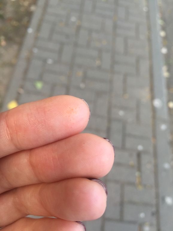 Сыпь на пальцах возле ногтей чешется thumbnail