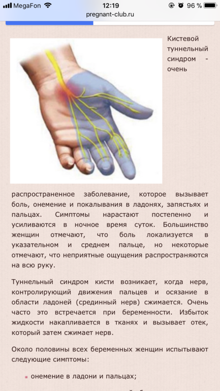 Причины, по которым немеет левая рука от локтя до плеча