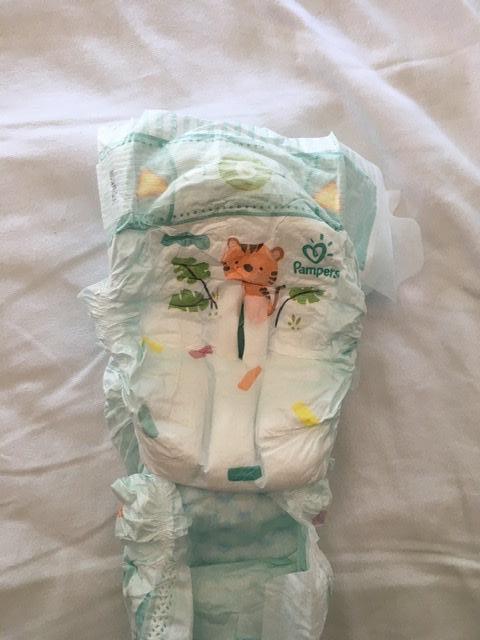 Гипоспадия. Опыт в Германии. — 38 ответов | форум Babyblog