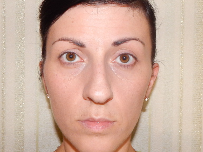 Как можно поменять свою форму глаз и лицо