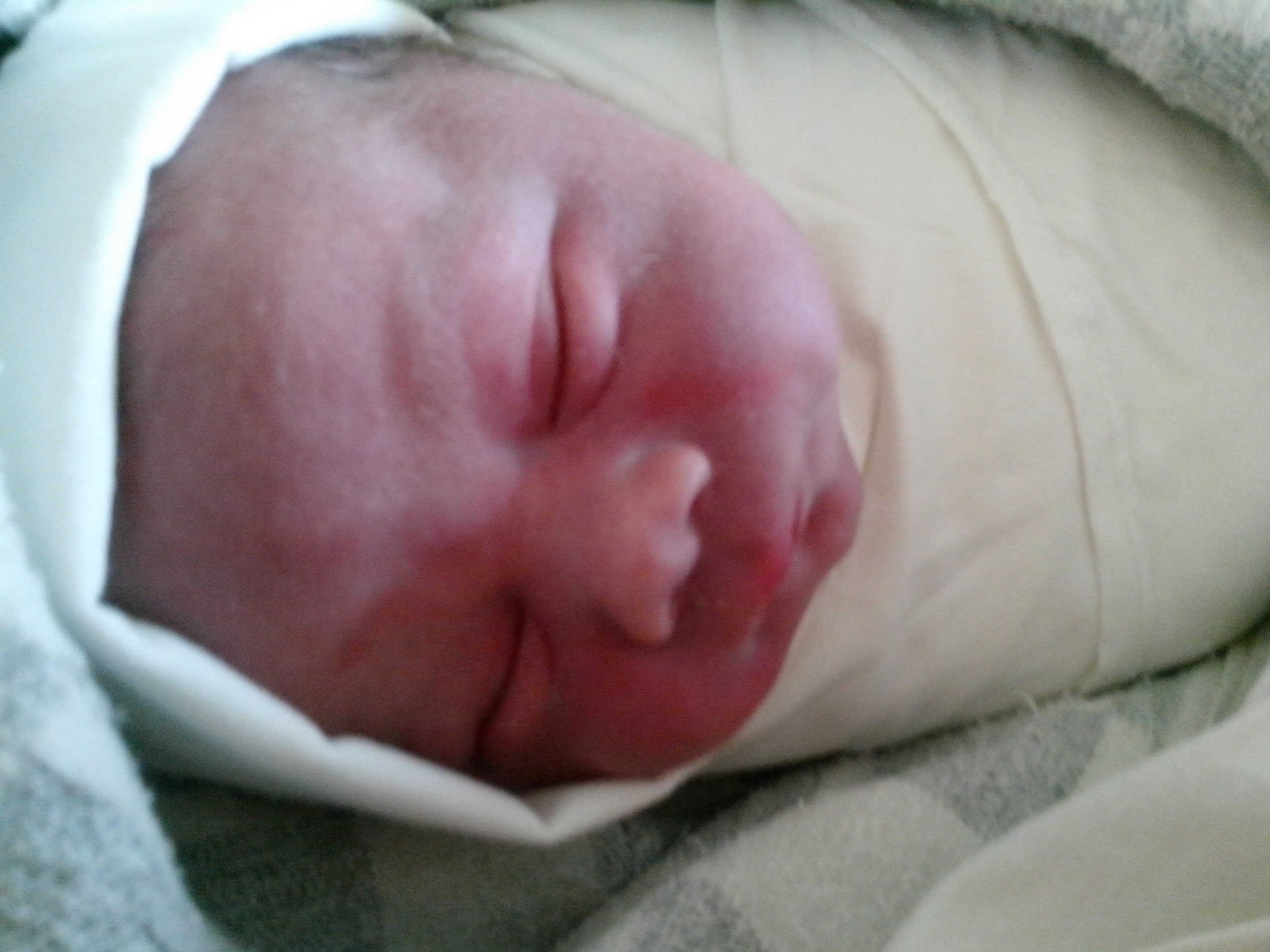 вторая беременность и роды