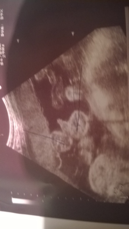 1d8368558713f8c8c61959477e6ca322.jpg