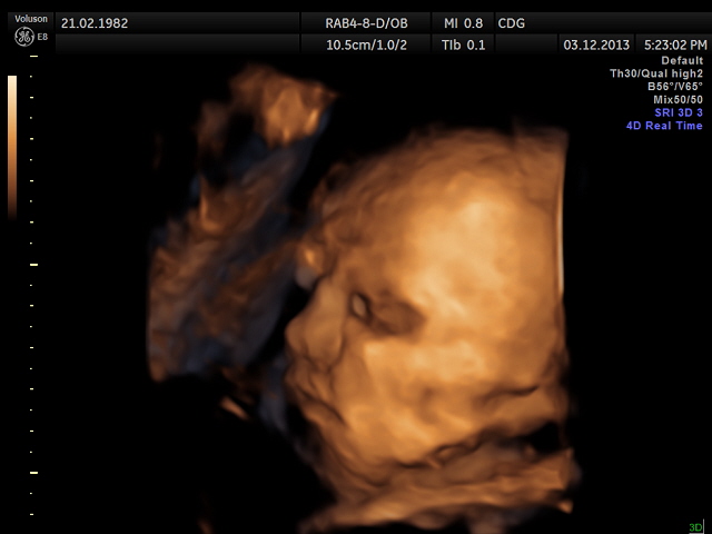 Вчера были на УЗИ))