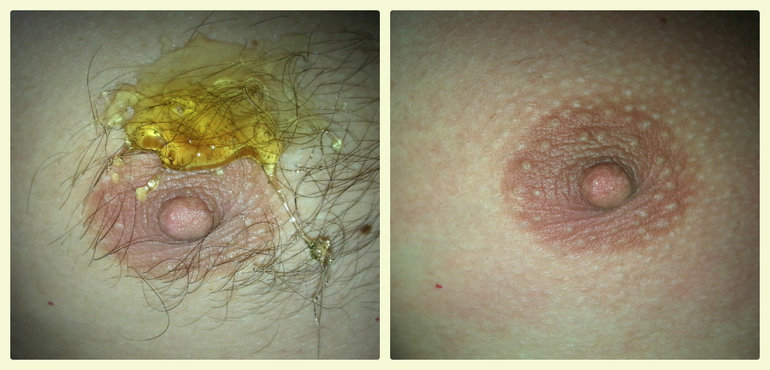 наш с мужем опыт домашнего шугаринга