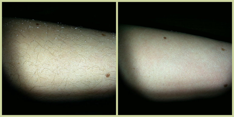 наш с мужем опыт домашнего шугаринга