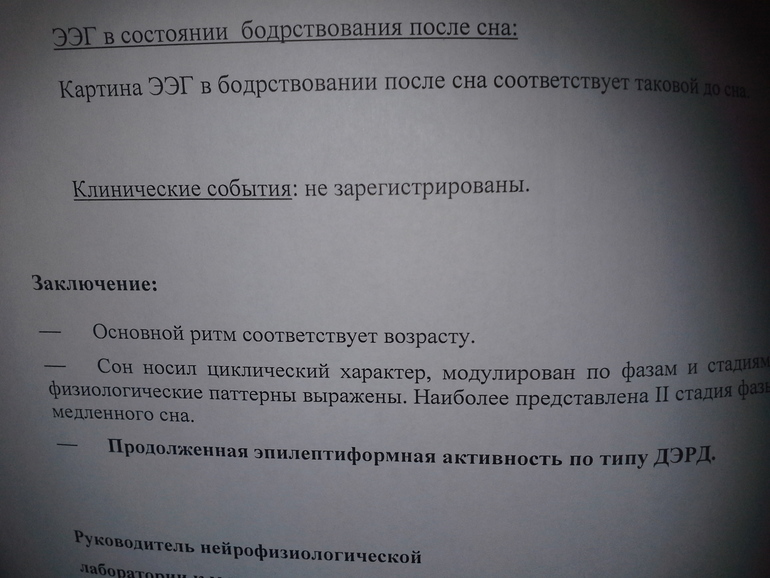 результат ночного ээг мониторинга