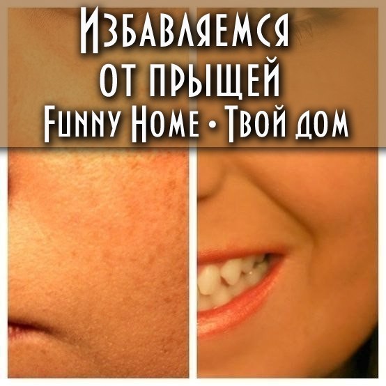 НАВСЕГДА ИЗБАВИТЬСЯ ОТ ПОЯВЛЕНИЯ ПРЫЩЕЙ