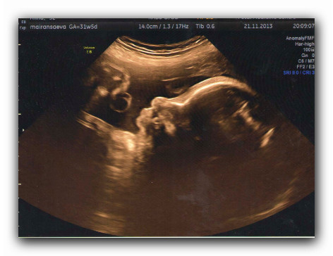 3D узи. Есть сходство?:)