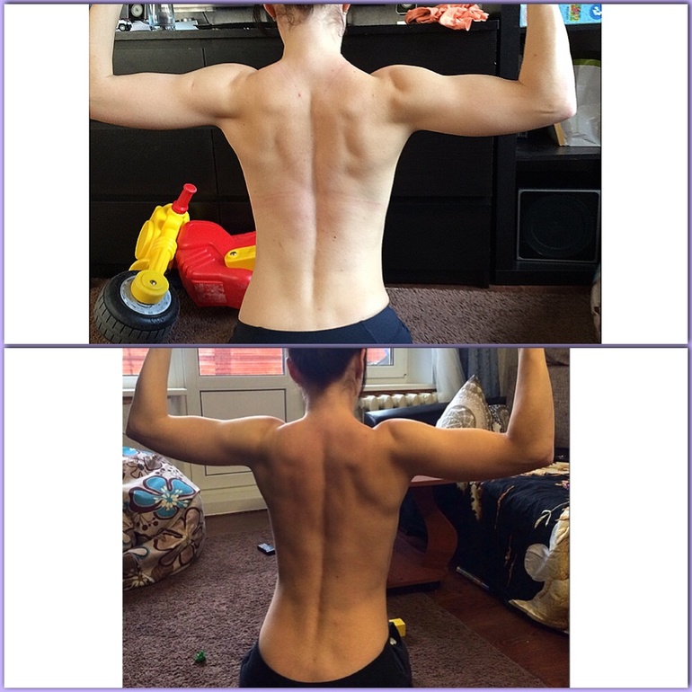 Опять моя спина)