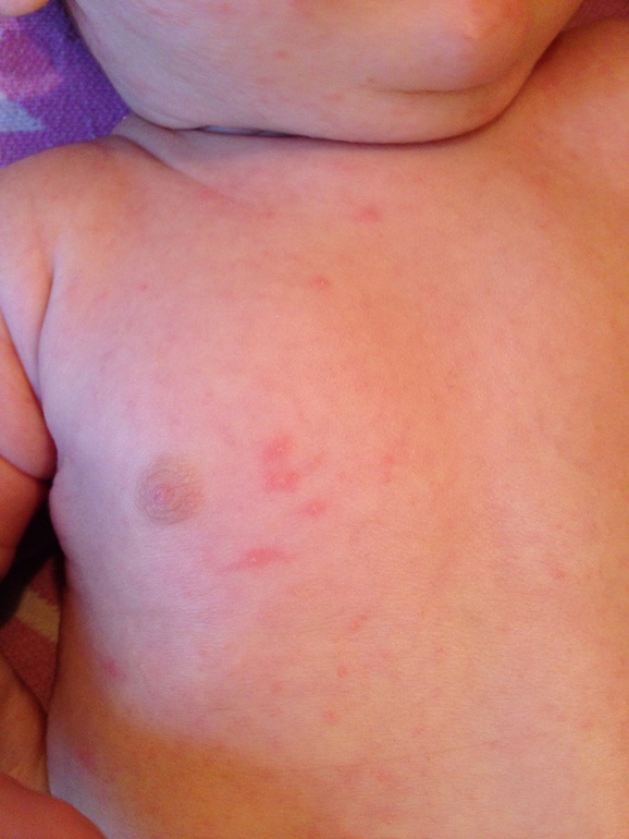 Нас обсыпало(((