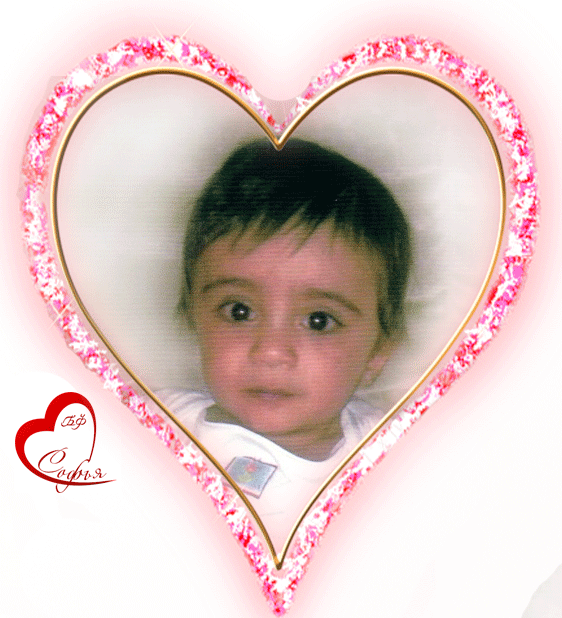 Малышу нужна операция!