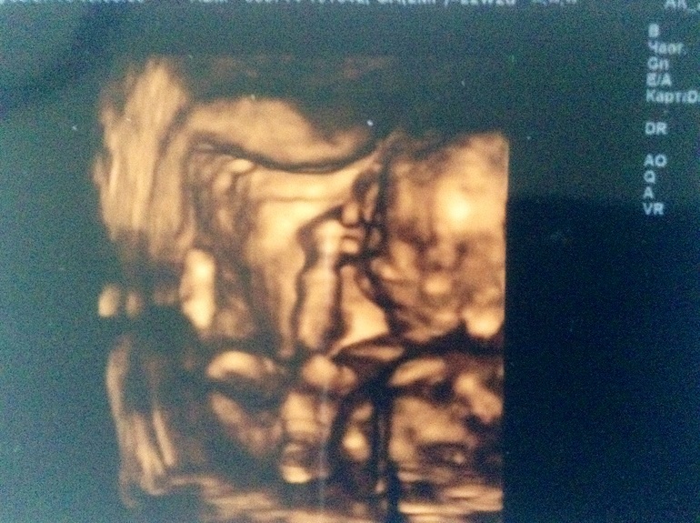 А у нас третья девочка!