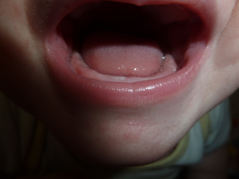 5a2dbf71523b37d6fe3b74158c2692bf.jpg