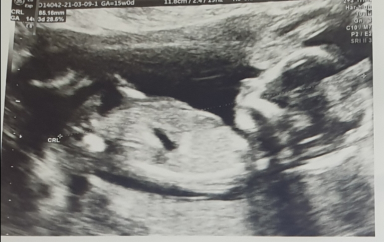 16 неделя беременности: ощущения, размер и развитие плода | Шестнадцатая неделя беременности