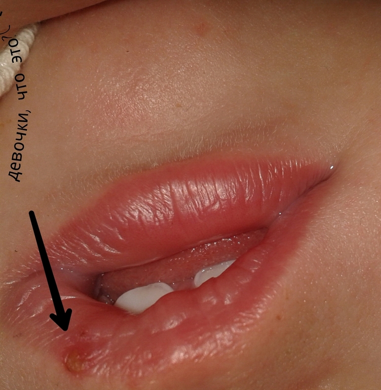 девочки! !!!что это?