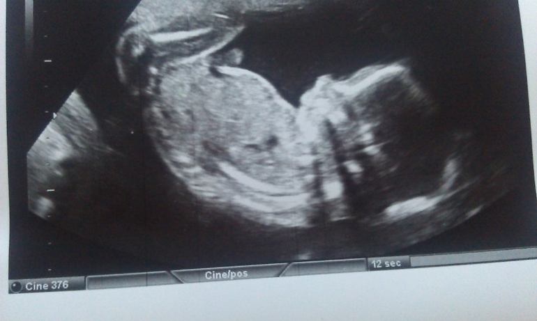 Мой сладенький! 20 н+2