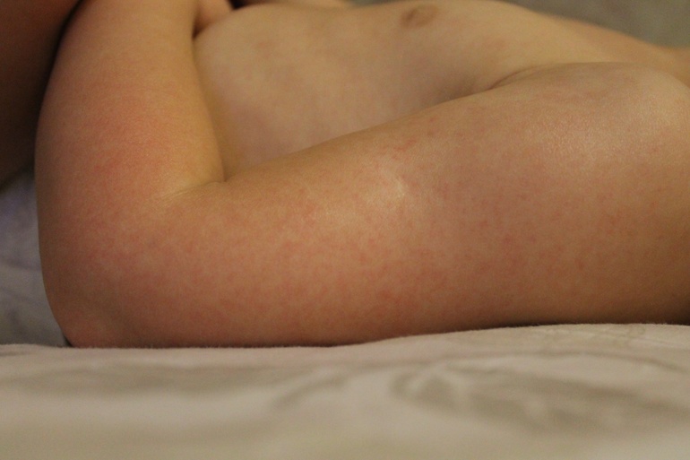 Рис!!! или записки сумасшедшего...